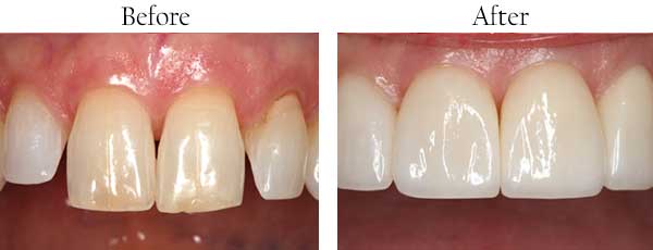 dental images 21043